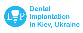 Dental Implantation in Kiev, Ukraine | Dental Tourism